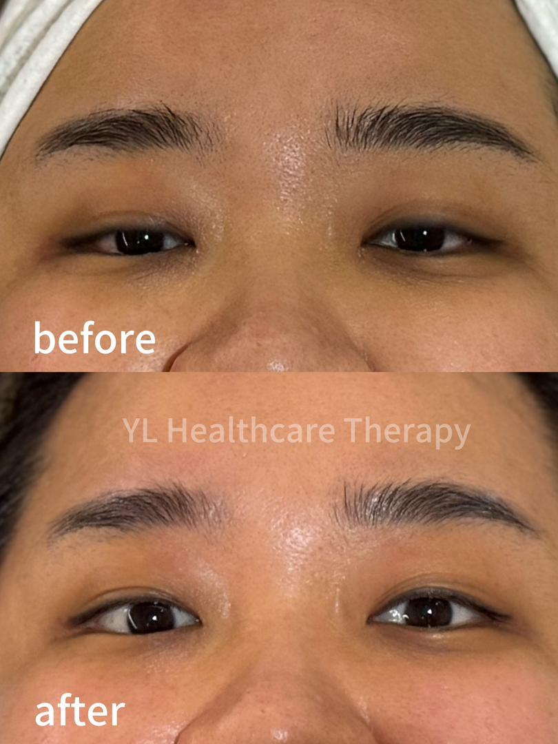 Advanced Eye Anti-Aging Treatment reference