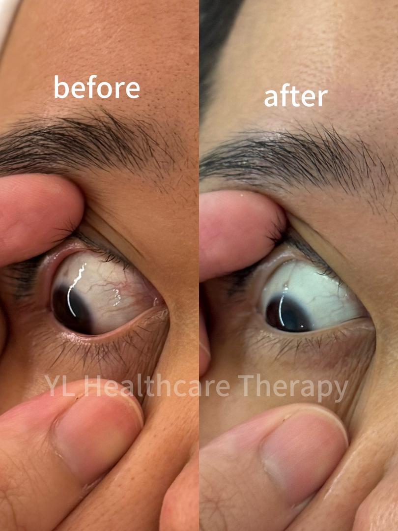 Advanced Eye Anti-Aging Treatment reference