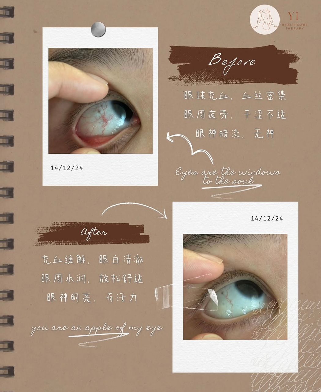 Advanced Eye Anti-Aging Treatment reference