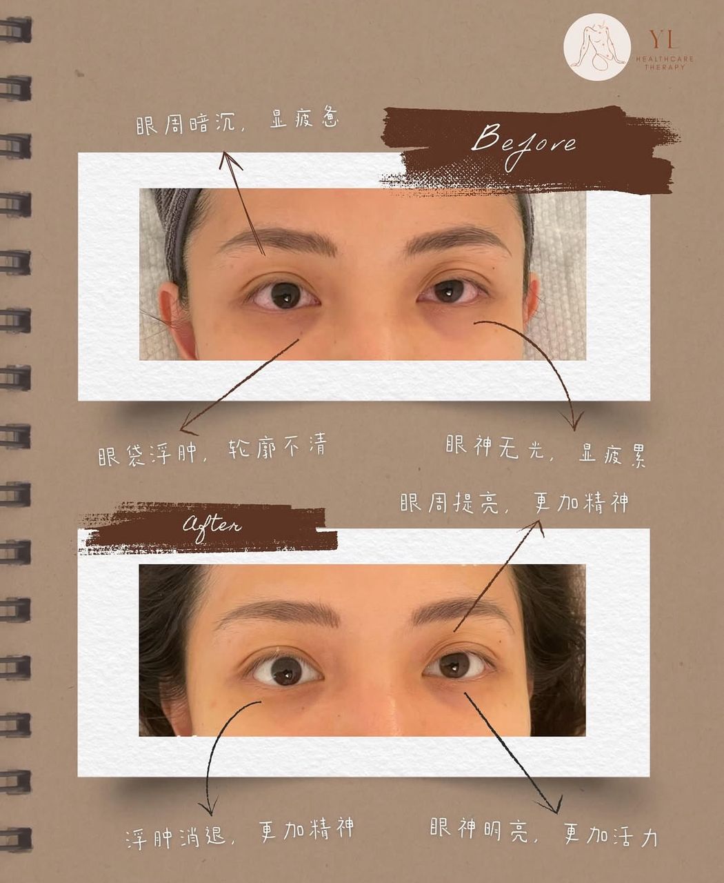 Advanced Eye Anti-Aging Treatment reference