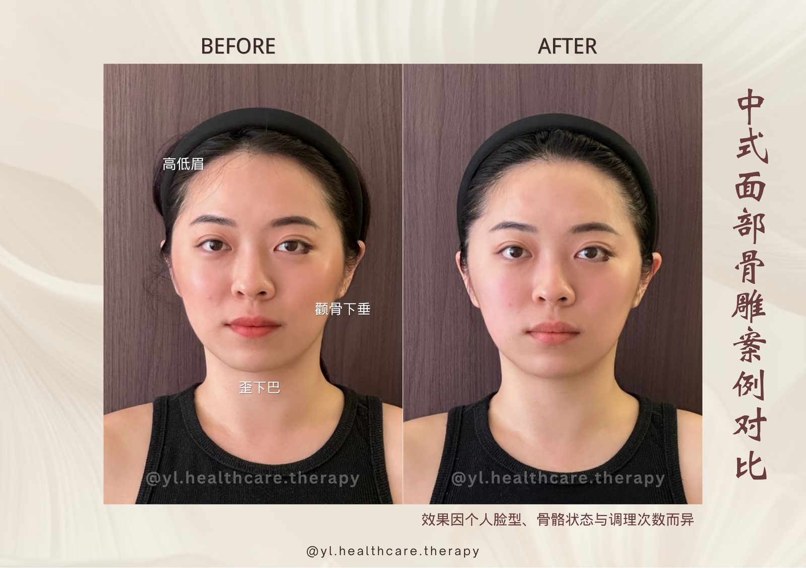 Oriental Facial Resculpture reference