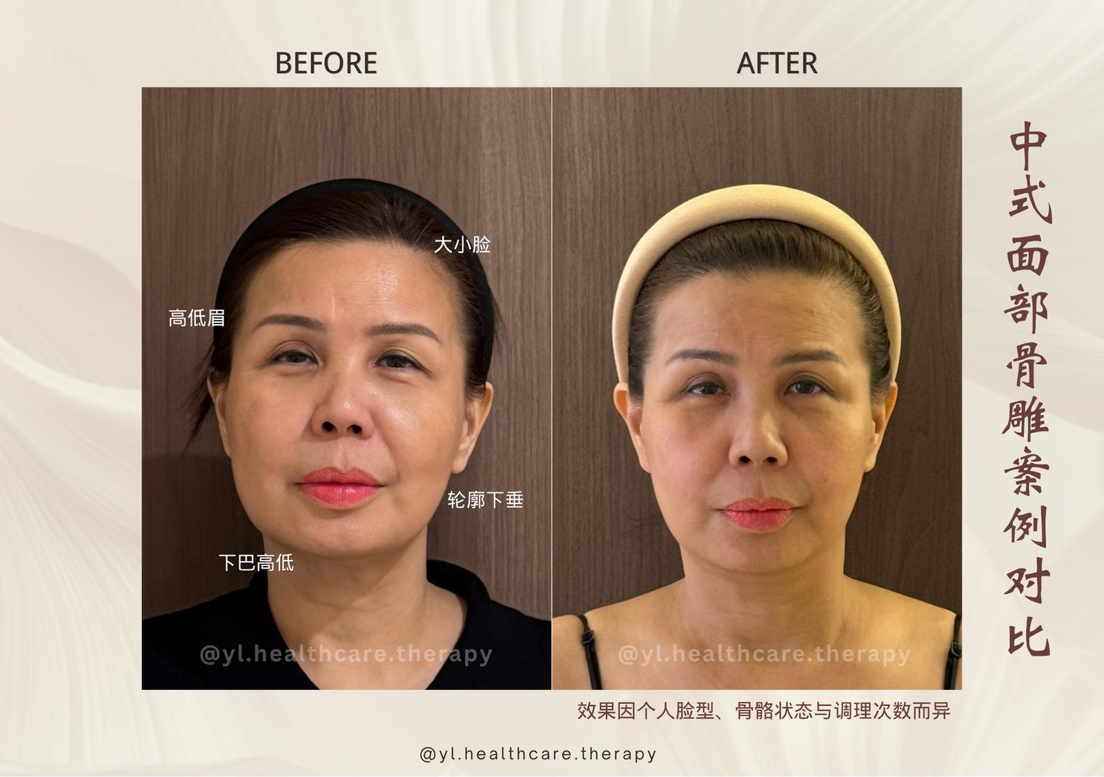 Oriental Facial Resculpture reference