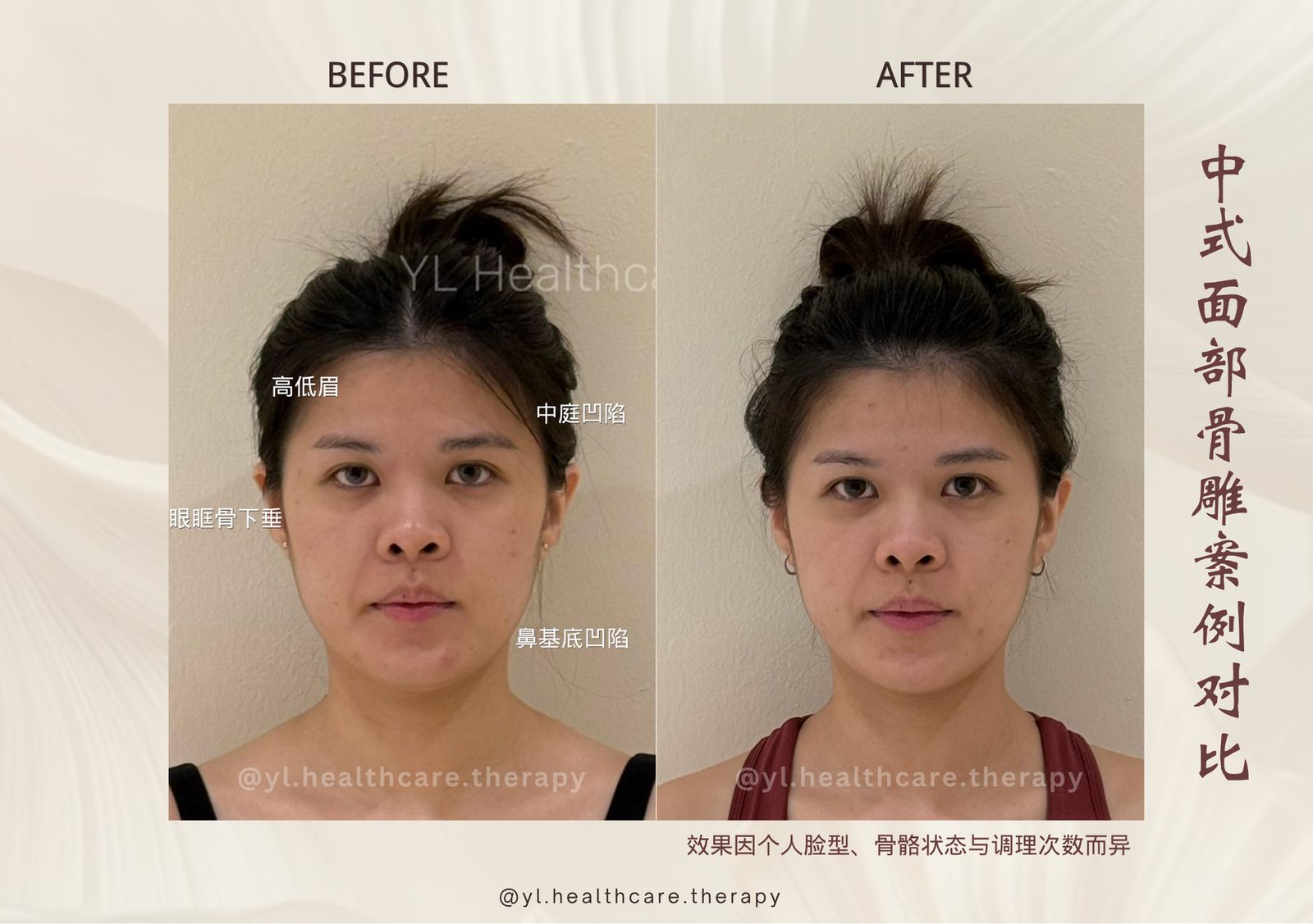 Oriental Facial Resculpture reference