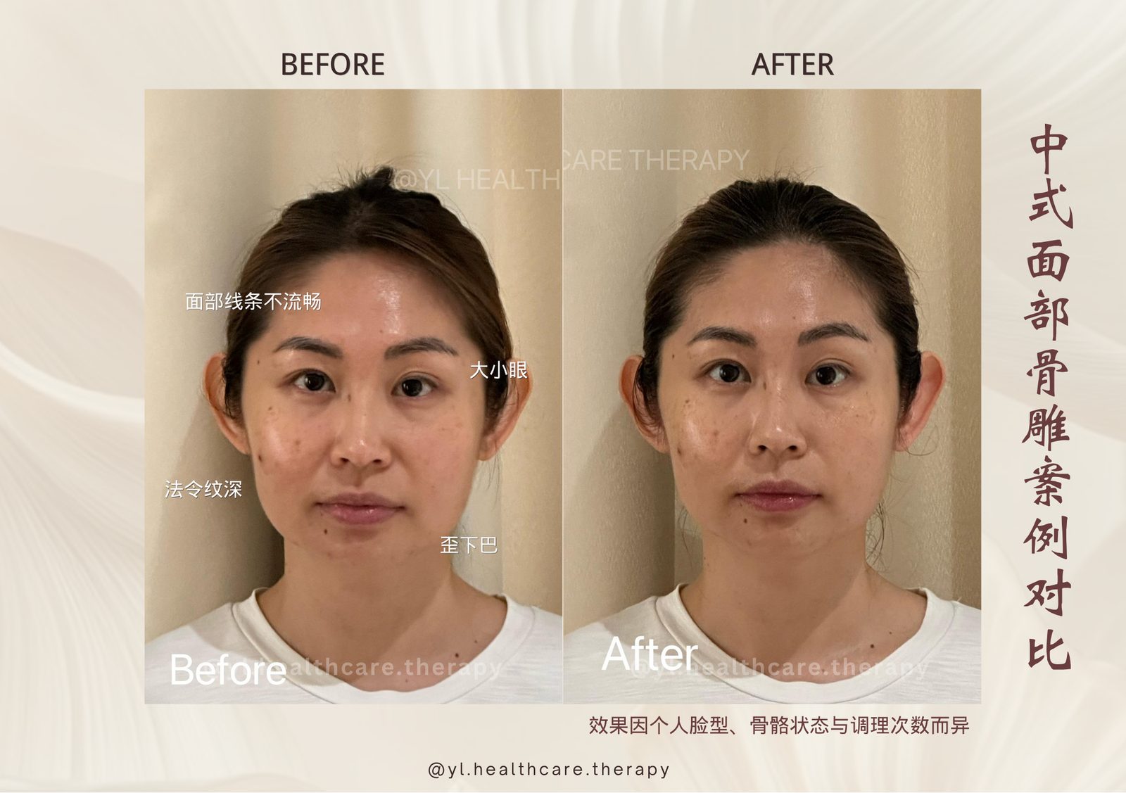 Oriental Facial Resculpture reference