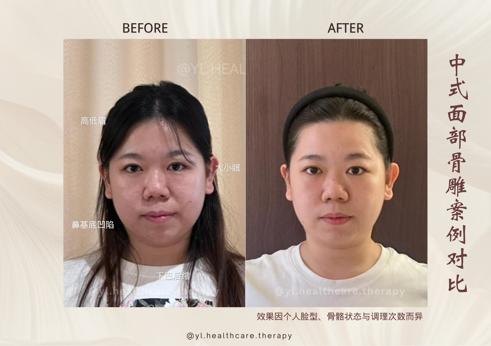 Oriental Facial Resculpture reference
