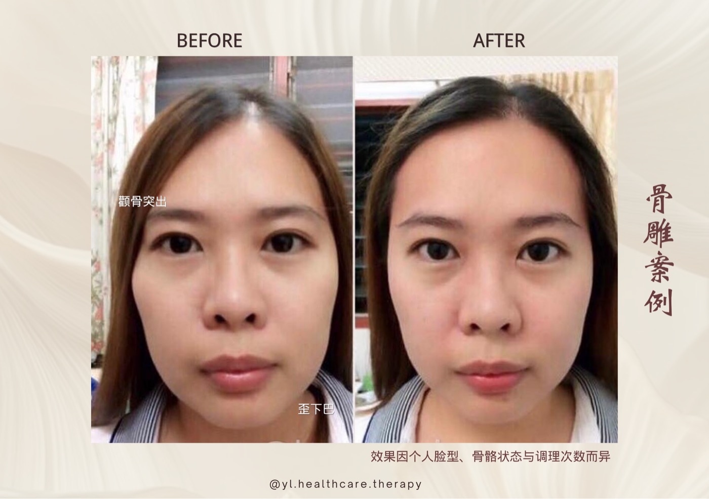 Oriental Facial Resculpture reference