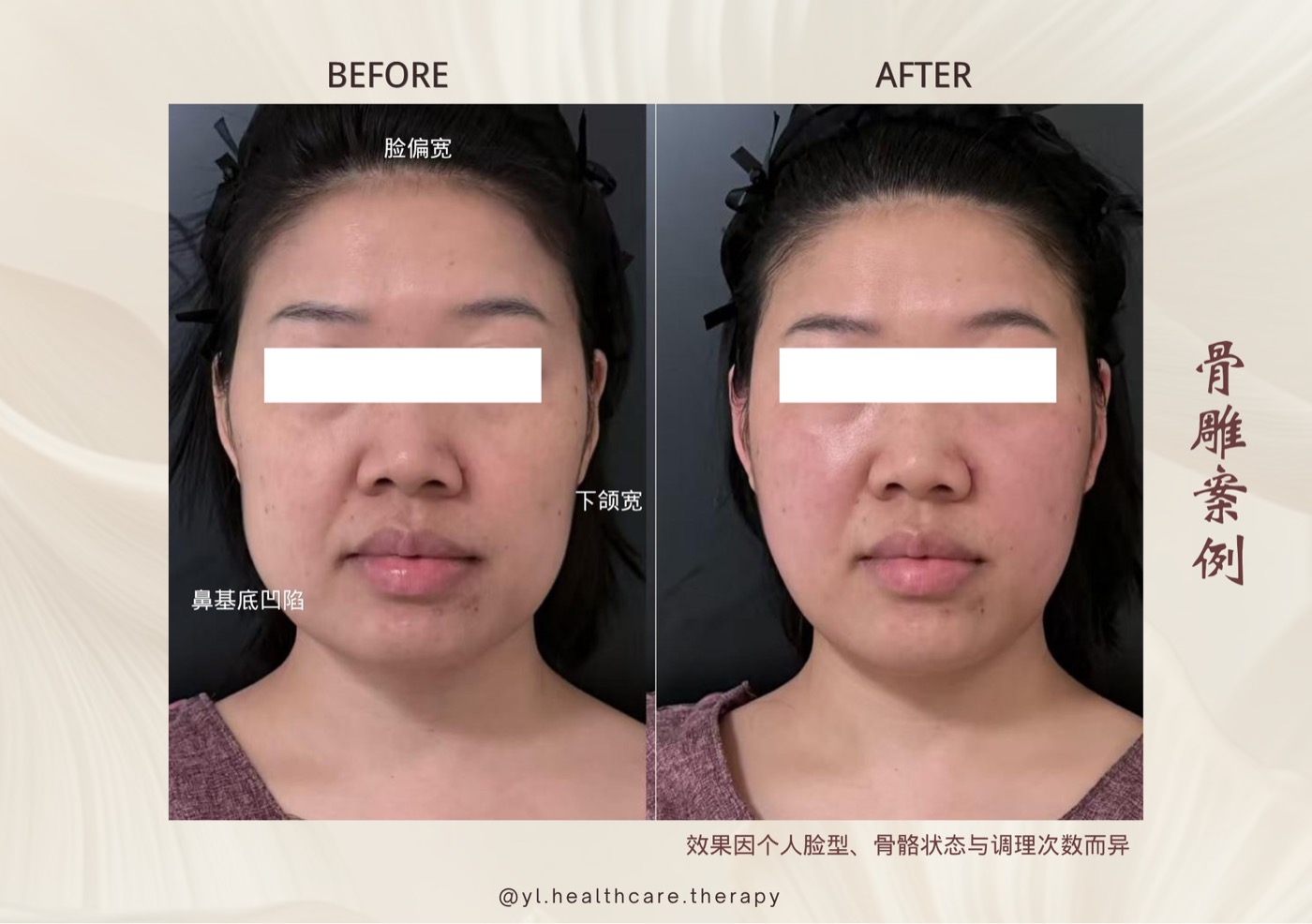 Oriental Facial Resculpture reference