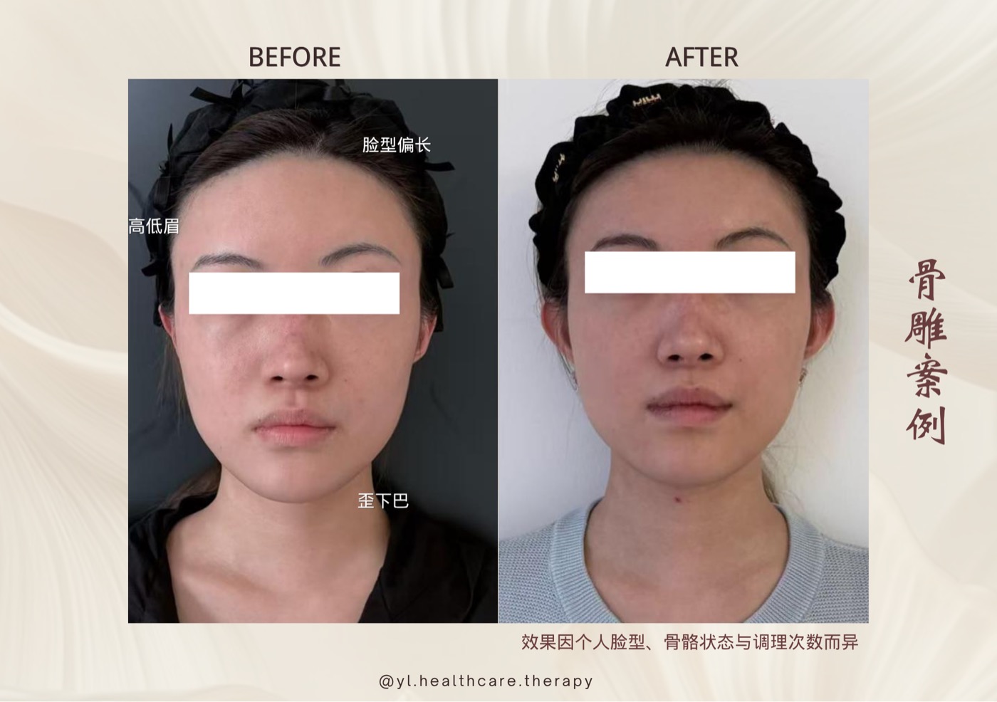 Oriental Facial Resculpture reference