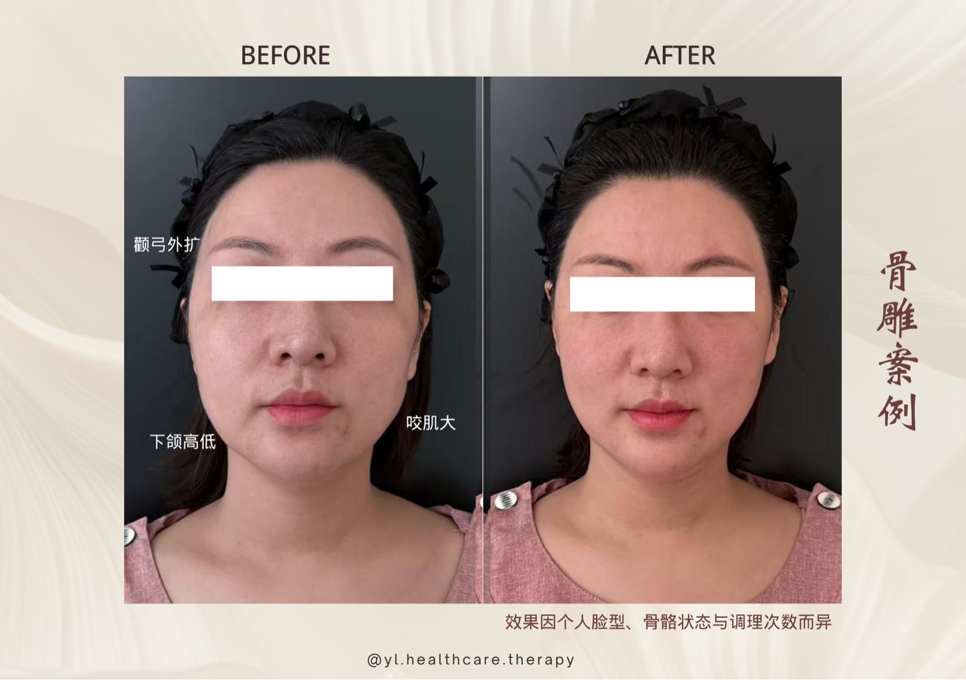 Oriental Facial Resculpture reference