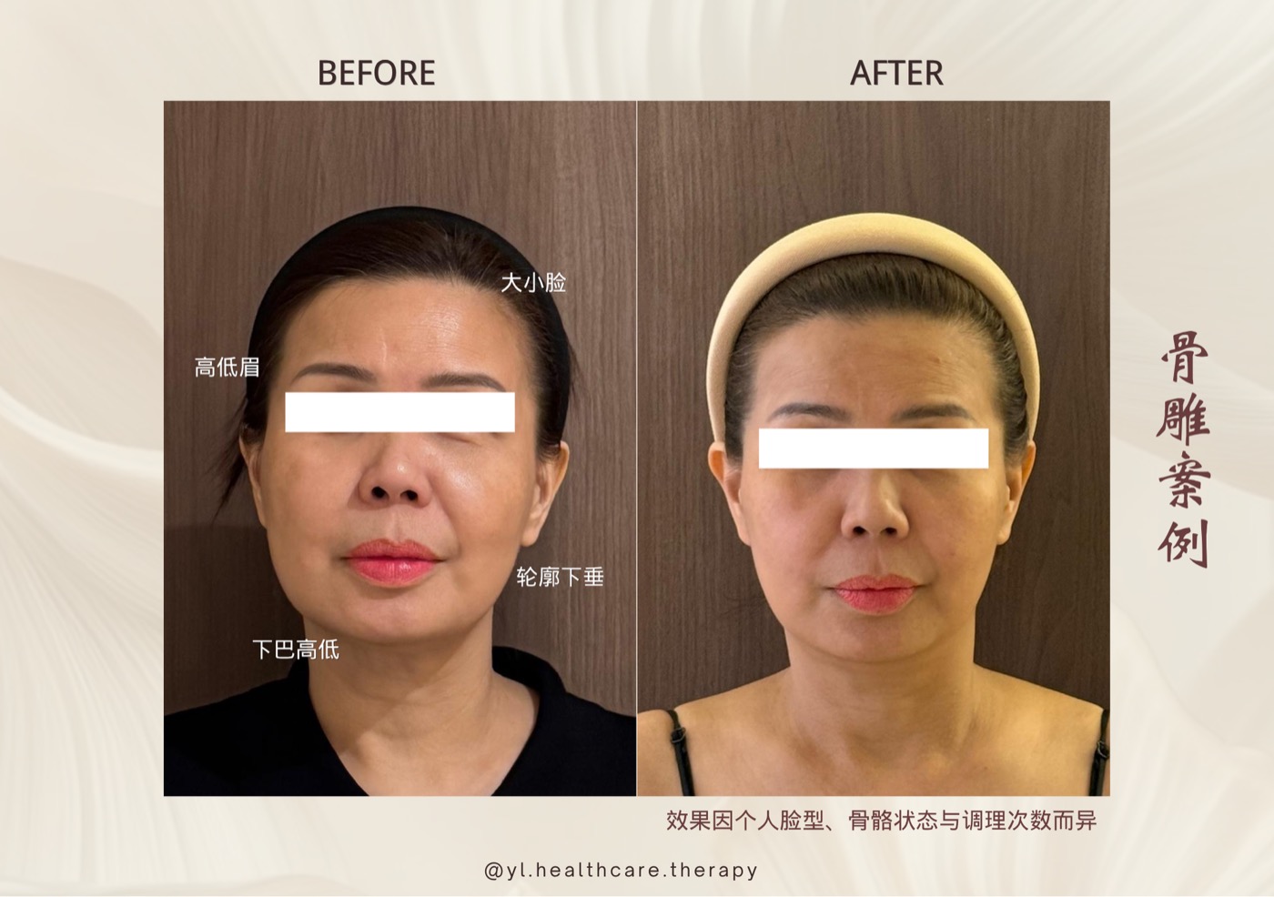 Oriental Facial Resculpture reference