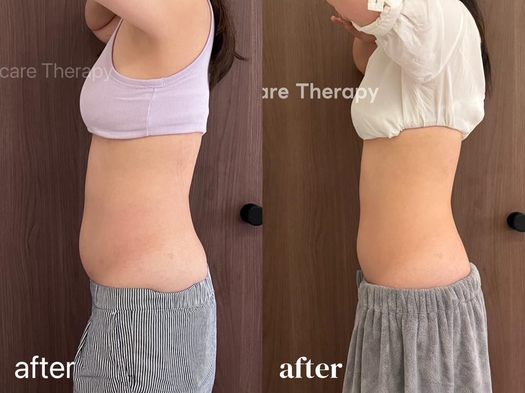 Metabolism Reset Treatment reference