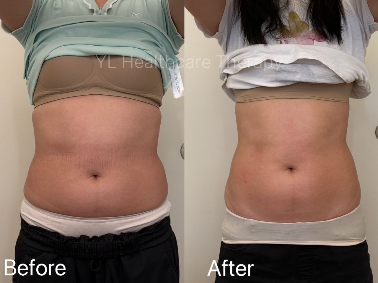 Metabolism Reset Treatment reference