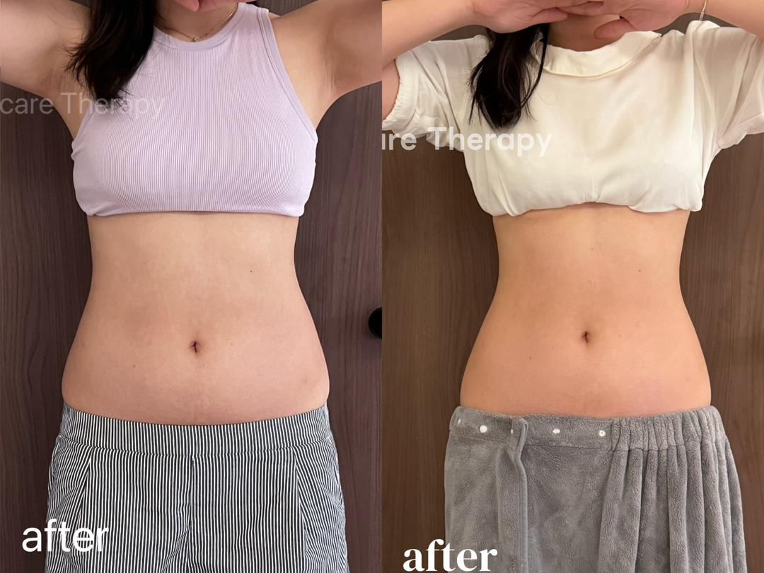 Metabolism Reset Treatment reference