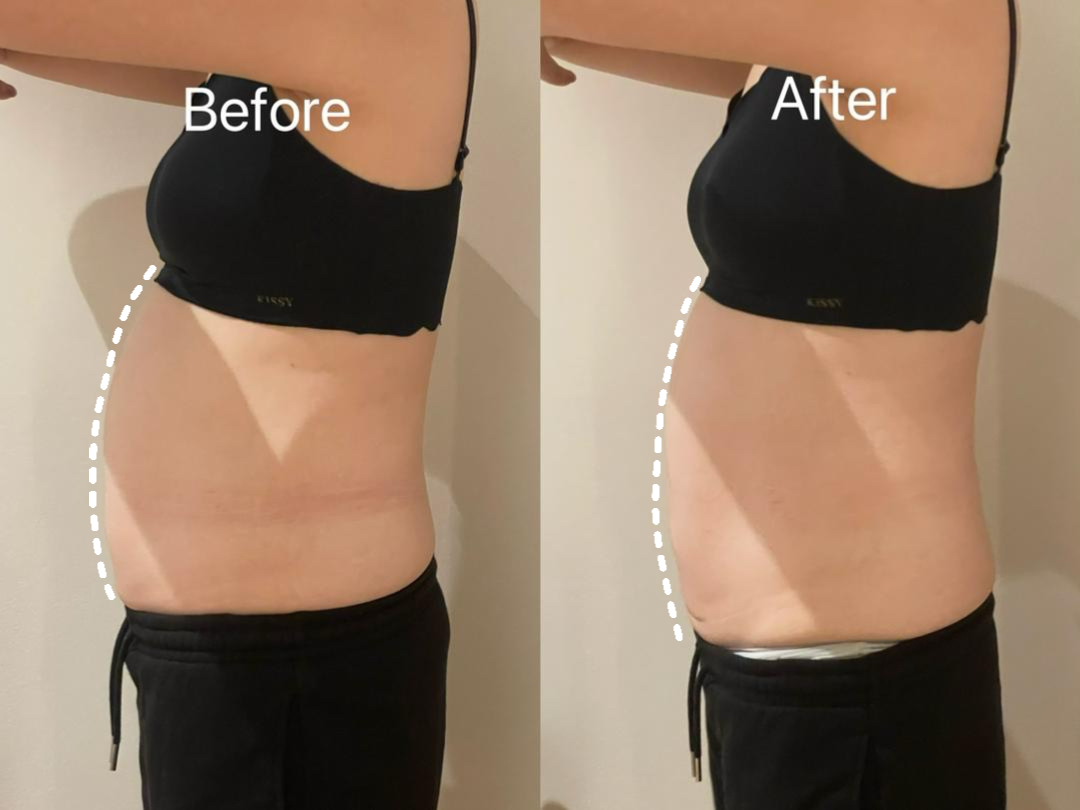 Metabolism Reset Treatment reference